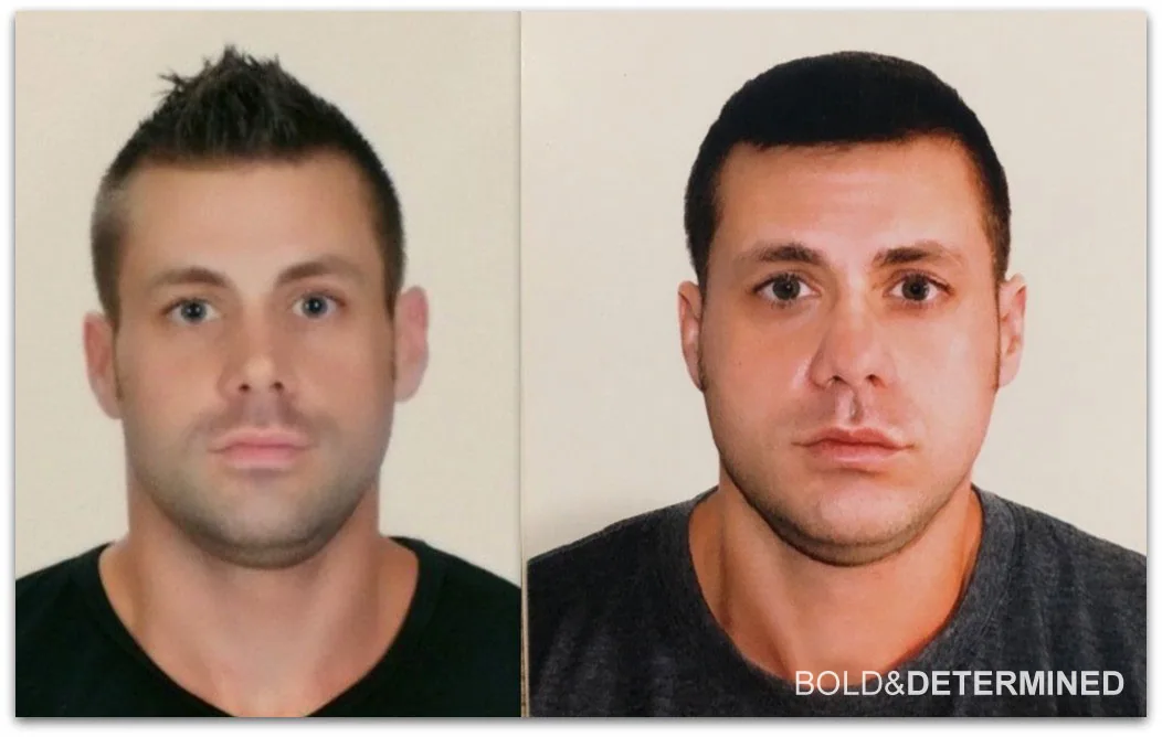 bloated-puffy-face-vs-skinny-thin-face-before-and-after